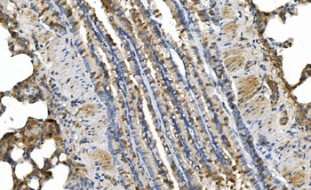 cGKI/PRKG1 Rabbit Polyclonal Antibody