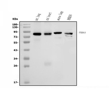 cGKI/PRKG1 Rabbit Polyclonal Antibody