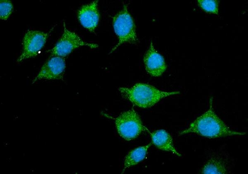 SLC10A1/NTCP1 Rabbit Polyclonal Antibody