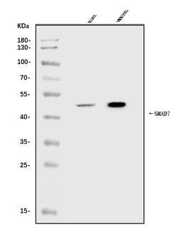 MADH7/SMAD7 Rabbit Polyclonal Antibody