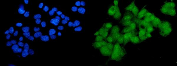 SOX18 Rabbit Polyclonal Antibody