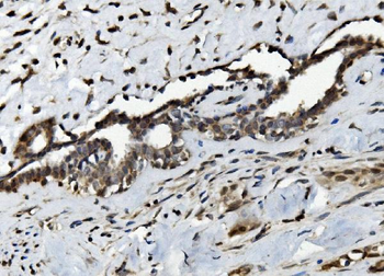 Serum Response Factor/SRF Antibody