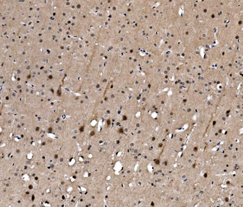 Serum Response Factor/SRF Antibody