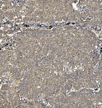 SV2A Rabbit Polyclonal Antibody