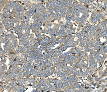 SV2A Rabbit Polyclonal Antibody