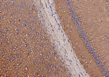 SV2A Rabbit Polyclonal Antibody