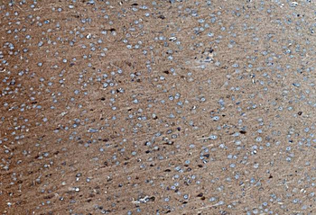 SV2A Rabbit Polyclonal Antibody