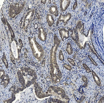 SMAD2 Mouse Monoclonal Antibody