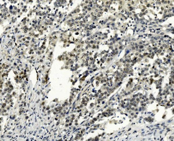 SMAD2 Mouse Monoclonal Antibody