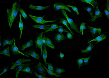 IRF3 Mouse Monoclonal Antibody