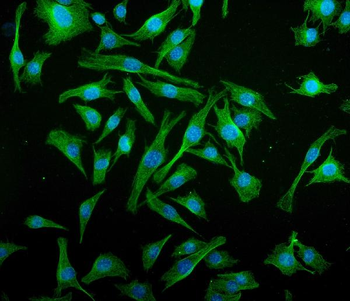 IRF3 Mouse Monoclonal Antibody