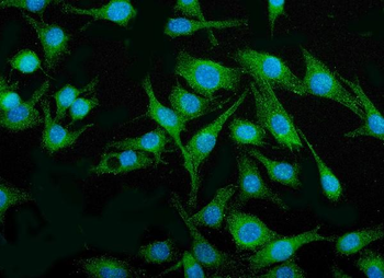 IRF3 Mouse Monoclonal Antibody
