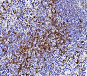 CD5 Mouse Monoclonal Antibody