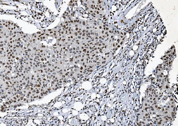SAMHD1 Mouse Monoclonal Antibody