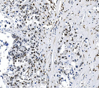 SAMHD1 Mouse Monoclonal Antibody