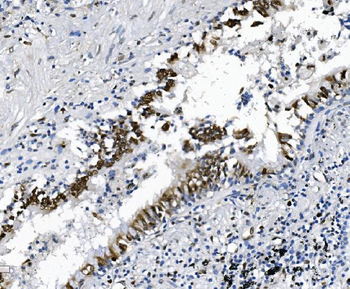 SAMHD1 Mouse Monoclonal Antibody