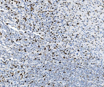 SAMHD1 Mouse Monoclonal Antibody