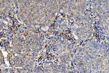 PNP Antibody (monoclonal, 7G5)