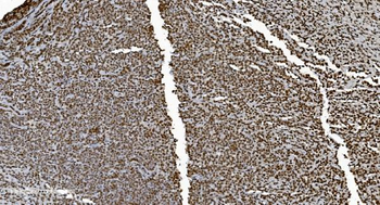 Ku70 Mouse Monoclonal Antibody