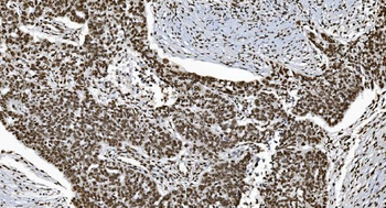 Ku70 Mouse Monoclonal Antibody