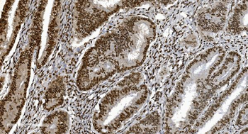 Ku70 Mouse Monoclonal Antibody