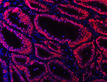 Ku70 Mouse Monoclonal Antibody