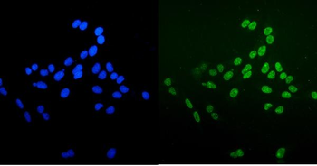 Ku70 Mouse Monoclonal Antibody