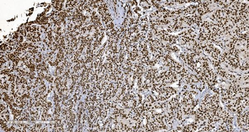 Ku70 Mouse Monoclonal Antibody
