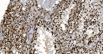 Ku70 Mouse Monoclonal Antibody