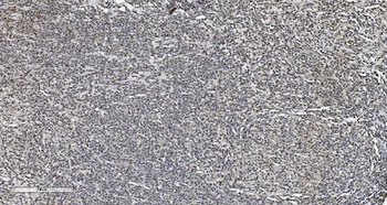 HP1 alpha/CBX5 Antibody (monoclonal, 8G6)