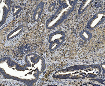 Integrin beta 5/ITGB5 Antibody (monoclonal, 9E2)
