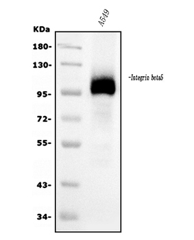 Integrin beta 5/ITGB5 Antibody (monoclonal, 9E2)
