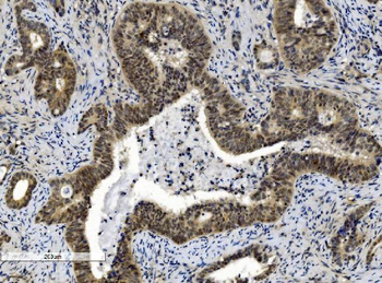 Cbx8 Mouse Monoclonal Antibody
