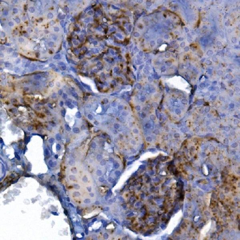 CD34 Rabbit Polyclonal Antibody