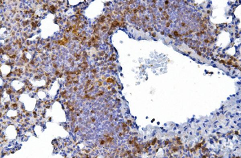 CD226 Rabbit Polyclonal Antibody