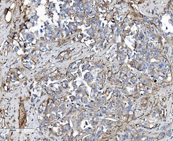 EHD3 Antibody
