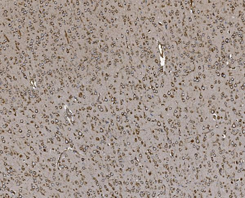 EPRS1/PARS Rabbit Polyclonal Antibody