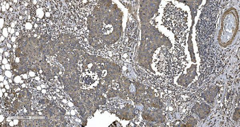 EPRS1/PARS Rabbit Polyclonal Antibody