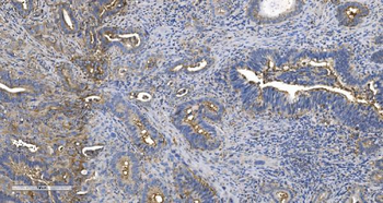 EPRS1/PARS Rabbit Polyclonal Antibody