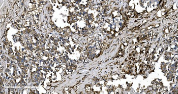 EPRS1/PARS Rabbit Polyclonal Antibody