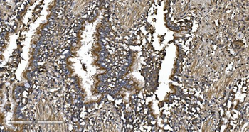 EPRS1/PARS Rabbit Polyclonal Antibody