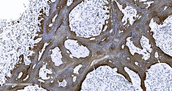 EPRS1/PARS Rabbit Polyclonal Antibody