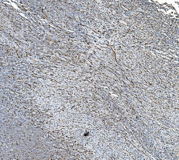 PDIA5 Rabbit Polyclonal Antibody
