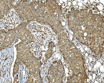 PDIA5 Rabbit Polyclonal Antibody