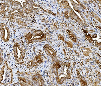 PDIA5 Rabbit Polyclonal Antibody