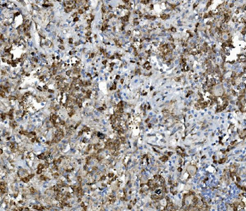 PDIA5 Rabbit Polyclonal Antibody