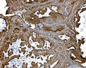 PDIA5 Rabbit Polyclonal Antibody