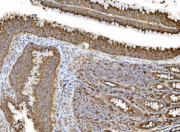 PDIA5 Rabbit Polyclonal Antibody