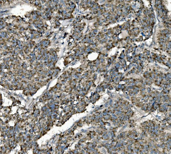 Prohibitin/PHB Antibody