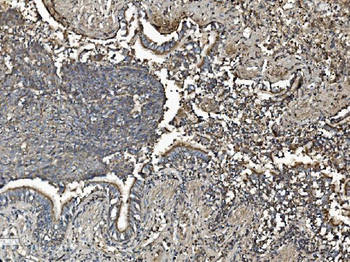 Prohibitin/PHB Antibody